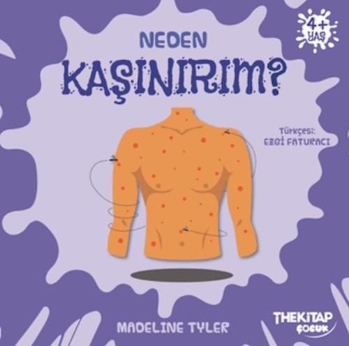 Neden Kaşınırım?